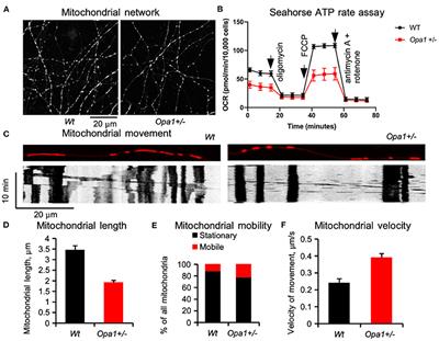 A Perspective on Accelerated Aging Caused by the Genetic Deficiency of the Metabolic Protein, OPA1